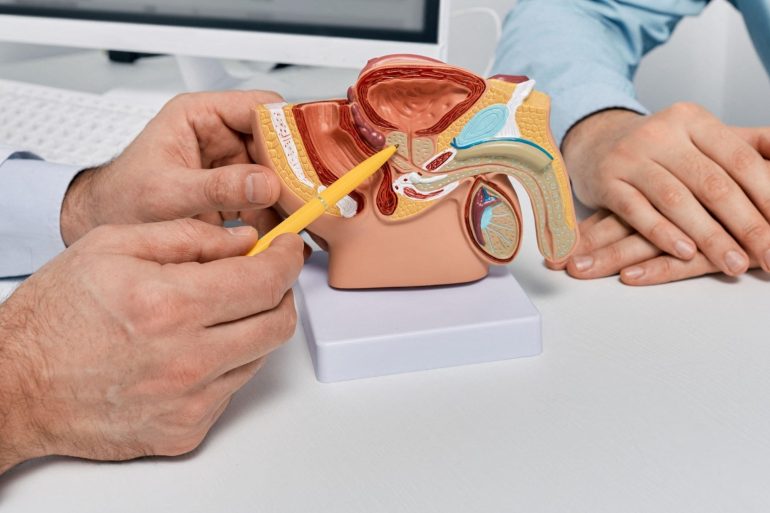 Screening For Prostate Cancer Likely To Reduce Deaths But Risks Remain  Review